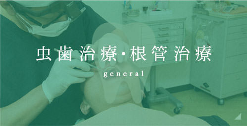 虫歯治療・根管治療 general